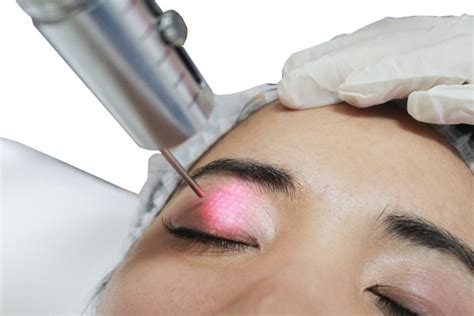 Eyes Rejuvenation Laser Pure Laser Clinic Indonesia