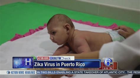 Some 30 People Get Rare Paralyzing Form Of Zika Virus In Puerto Rico