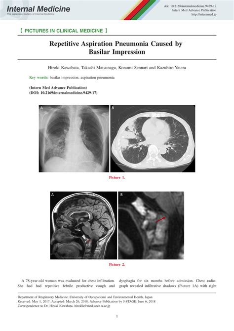 Pathophysiology Of Aspiration Pneumonia