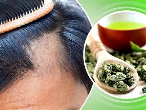 Twice daily decreased dht blood levels by 40 percent, allowing new hair strands to grow in thicker and more plentiful. How is green tea useful in preventing hair loss - lifealth
