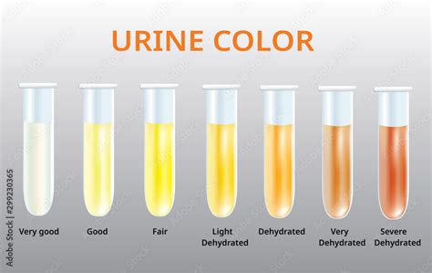Urine Color Chart Urine In Test Tubes Medical Vector Stock Vector