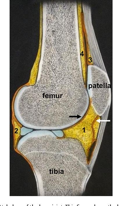 Figure 2 From The Infrapatellar Fat Pad Should Be Considered As An