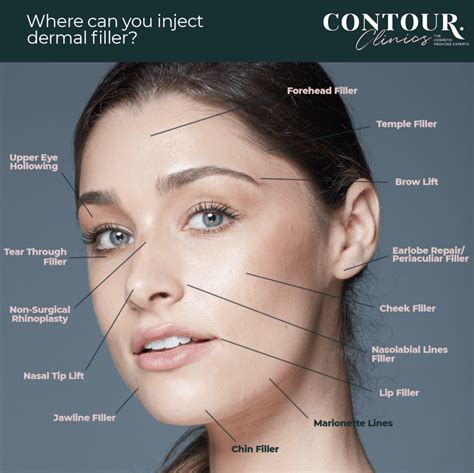 Dermal Fillers And Cheek Fillers Sydney Contour Clinics