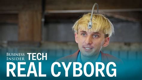This Real Life Cyborg Has An Antenna Implanted Into His Skull Youtube