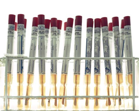 Cancer staging is often determined by biopsy results and helps determine the cancer type and the extent of cancer spread; Why You Need A Pap Smear & What Do Your Results Mean?