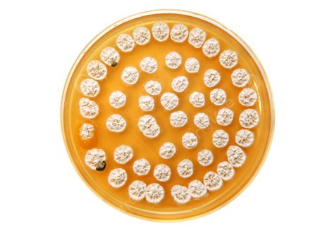 White Fungi On Agar Plate Study Science Study Round Png Transparent