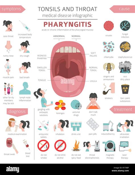 Amygdales Et De La Gorge Les Symptômes De La Pharyngite Icône De