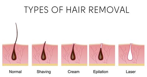 Most Advanced Laser Hair Removal Technology Clearstone Laser Hair