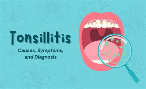 Tonsillitis Causes Symptoms And Diagnosis Resurchify