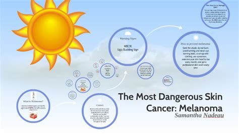 The Most Dangerous Skin Cancer Melanoma By Samantha Nadeau