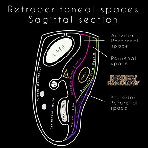 Retroperitoneal Space Sagittal Anatomy • Anterior Grepmed