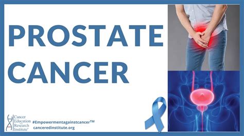 Cancer Education Prostate Cancer Symptoms Early And Late Stages