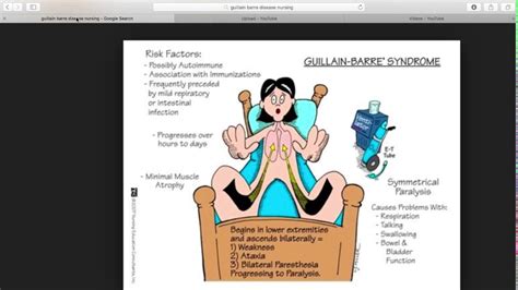 Could a single study suffice? Guillain barre syndrome - YouTube