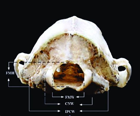 Caudal View Of Hedgehog Skull Showing Foramen Magnum Height Fmh
