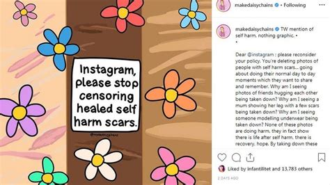 Instagram I Don T Want People To Be Ashamed Of Their Scars BBC News