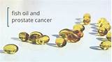 Fish Oil And Cancer Treatment Pictures