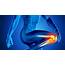 Possible Causes Of Severe Knee Pain
