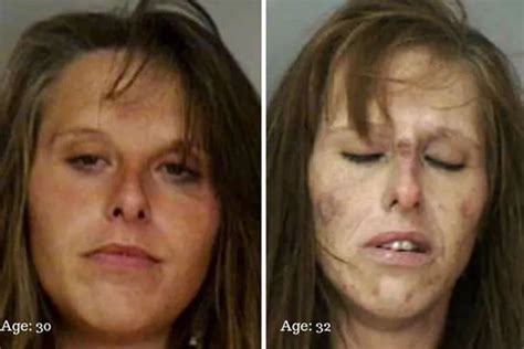 Krokodil Before And After