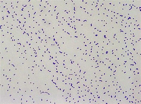 Streptococcus pneumonia is gram stain positive. Strep.equi_gram.jpg (1002×746) (con imágenes)