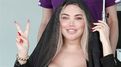 Ex Human Ken Doll Jessica Alves Looks Unrecognisable After Full Facelift Head Reduction Surgery
