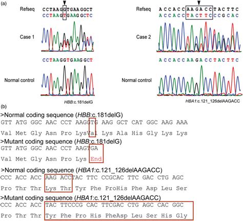 A Sanger Sequencing Validation Of The Two Novel Variants B Amino Download Scientific