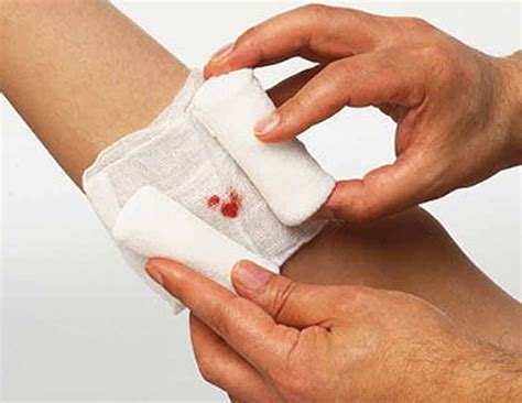Perfect Way To Treat Wounds At Home Lifeberrys Com