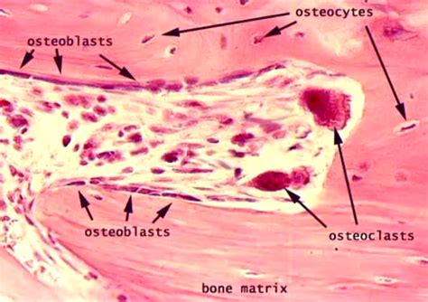 Imagequiz Bone Cells