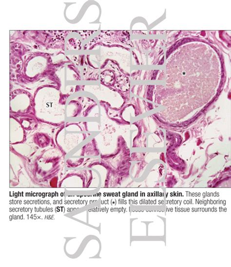 Light Micrograph Of An Apocrine Sweat Gland In Axillary Skin