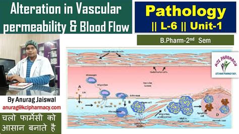 Alteration In Vascular Permeability And Blood Flow L 6 Unit 1