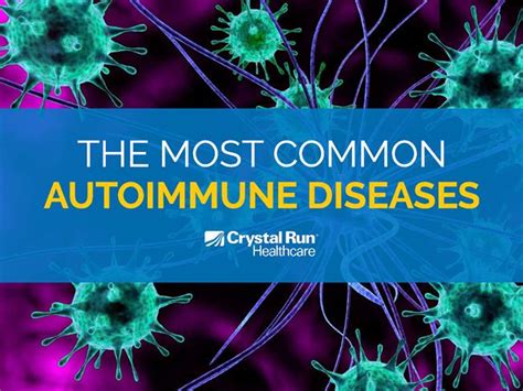 The Most Common Autoimmune Diseases Authorstream