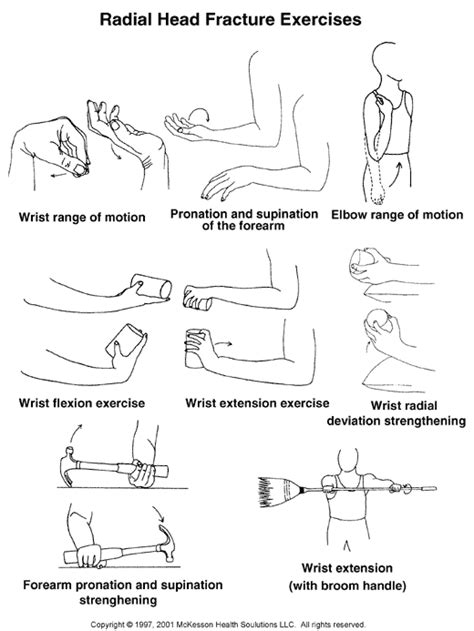 Elbow Exercises After Radial Head Fracture Exercisewalls