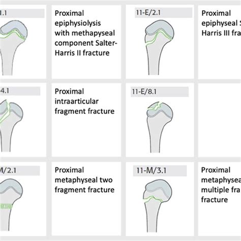 Fracture Classification According To The AO OTA Classification System Download Scientific