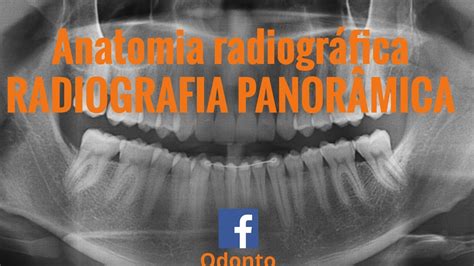 Anatomia Radiográfica Panorâmica Youtube