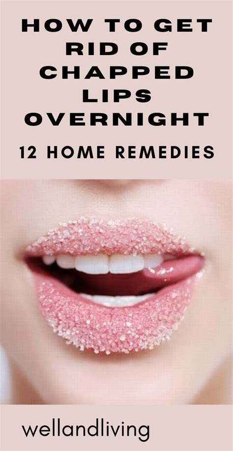 12 Home Remedies To Get Rid Of Chapped Lips Overnight Well And Living