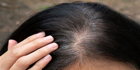 What Causes Grey Hair In Teenage Years Natural Hair Insights