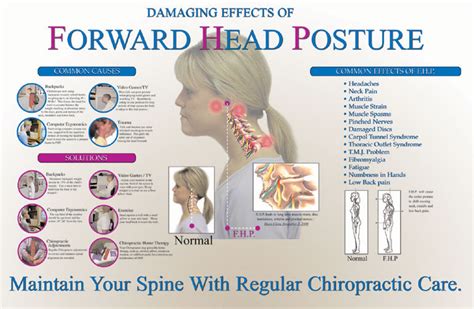 Sounds simple but it has many health implications regarding not only pain, but your entire body making correcting forward head posture a key to relief & restoration. Causes and Correction of FHP - Shelby Family Chiropractic