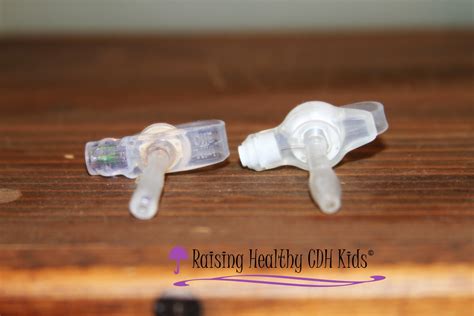 Raising Diaphragmatic Hernia Children G Tube Choices