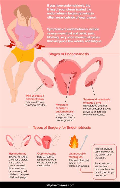 Endometriosis Surgery And How To Support Recovery Fatty Liver Disease