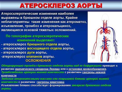 Диета при аневризме аорты брюшной Атеросклероз аорты брюшной полости диета - фото презентация Атеросклероз аорты брюшной полости диета - фото презентация Диета при аневризме аорты брюшной