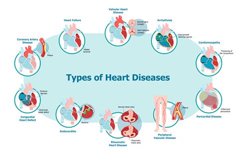 Cardiology Services Best Heart Specialists In Malaysia