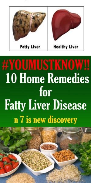 Home Remedies For Fatty Liver Disease