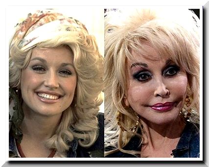 Dolly Parton Has Done Plastic Surgery to Almost All Her ...