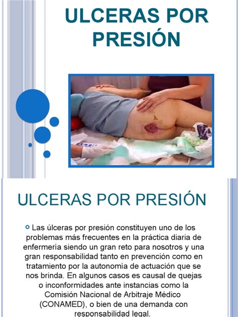 Presentación Ulceras Por PresiÓn Piel Isquemia