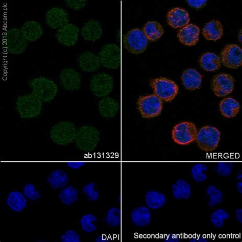 recombinant anti nme2 antibody [epr8351] bsa and azide free ab248409 abcam