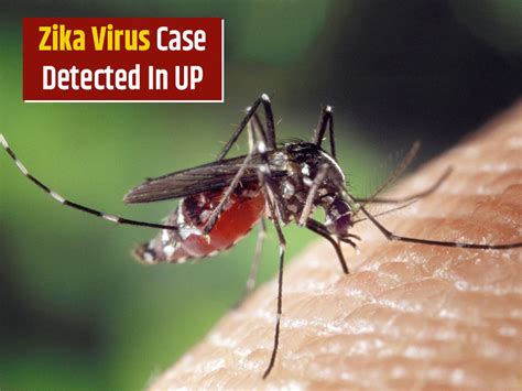 1st Zika Virus Case Of Up Recorded In Kanpur Iaf Officer Infected Onlymyhealth