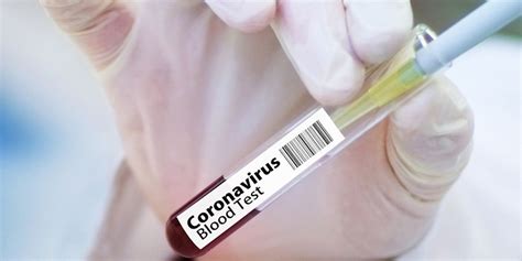 Sieben französische gewerkschaften gegen impfpflicht für feuerwehrleute › corona doks. Gesetzentwurf sieht keine Impfpflicht gegen Corona vor!