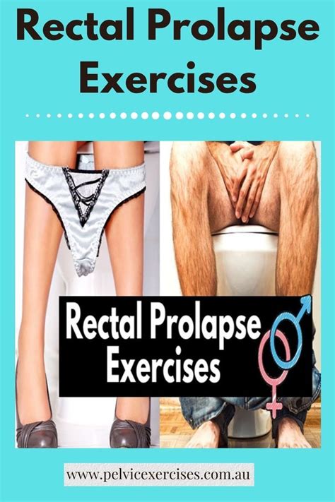 Rectal Prolapse Exercises Prolapse Exercises Pelvic Floor Exercises