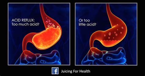 Acid Reflux How To Test If You Have Low Or High Stomach Acid