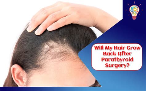 Will My Hair Grow Back After Parathyroid Surgery Updated Ideas