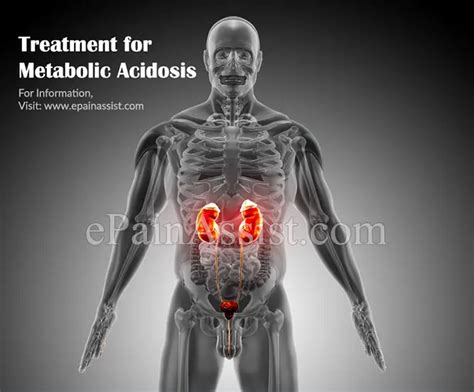 Metabolic Acidosis Causes Symptoms Diagnosis Treatment Prognosis Prevention